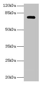 Western blot  | All lanes: MON1A antibody at 2µg/ml + U251 whole cell lysate  | Secondary  | Goat polyclonal to rabbit IgG at 1/10000 dilution  | Predicted band size: 73, 45, 34, 56, 63 kDa  | Observed band size: 73 kDa