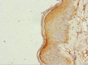 Immunohistochemistry of paraffin-embedded human skin tissue using ZC3HC1 Antibody at dilution of 1:100Rabbit anti-Human ZC3HC1 Polyclonal Antibody