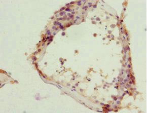 Immunohistochemistry of paraffin-embedded human testis tissue using ZC3HC1 Antibody at dilution of 1:100Rabbit anti-Human ZC3HC1 Polyclonal Antibody
