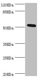 Western blot  | All lanes: ZC3HC1 antibody at 0.98µg/ml + Hela whole cell lysate  | Secondary  | Goat polyclonal to rabbit IgG at 1/10000 dilution  | Predicted band size: 56, 54, 48 kDa  | Observed band size: 54 kDaRabbit anti-Human ZC3HC1 Polyclonal Antibody