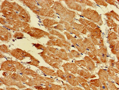 Immunohistochemistry of paraffin-embedded human heart tissue using LDHD Antibody at dilution of 1:100