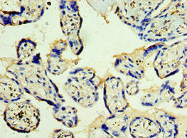 Immunohistochemistry of paraffin-embedded human placenta tissue using STX12 Antibody at dilution of 1:100Rabbit anti-Human STX12 Polyclonal Antibody