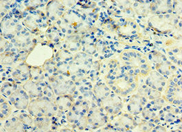 Immunohistochemistry of paraffin-embedded human pancreatic tissue using STX12 Antibody at dilution of 1:100Rabbit anti-Human STX12 Polyclonal Antibody