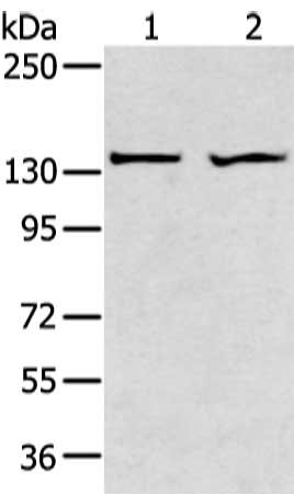 Gel: 6%SDS-PAGE, Lysate: 40 μg, Lane 1-2: A431 and 293T cell, Primary antibody: ADAMTS2 Antibody(ADAMTS2 Antibody) at dilution 1/200 dilution, Secondary antibody: Goat anti rabbit IgG at 1/8000 dilution, Exposure time: 1 minute
