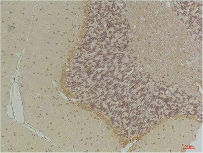 Immunohistochemical analysis of paraffin-embedded Rat BrainTissue using GABA Transporter 1 Rabbit pAb diluted at 1:200.Rabbit anti-Human SLC6A1 Polyclonal Antibody