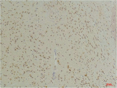 Immunohistochemical analysis of paraffin-embedded Mouse BrainTissue using GABA Transporter 1 Rabbit pAb diluted at 1:200.Rabbit anti-Human SLC6A1 Polyclonal Antibody