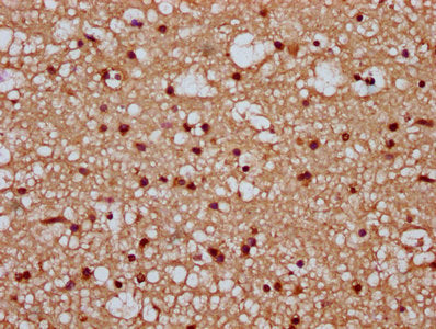 IHC image of TIPARP Antibody diluted at 1:300 and staining in paraffin-embedded human brain tissue performed on a Leica BondTM system. After dewaxing and hydration, antigen retrieval was mediated by high pressure in a citrate buffer (pH 6.0). Section was blocked with 10% normal goat serum 30min at RT. Then primary antibody (1% BSA) was incubated at 4°C overnight. The primary is detected by a biotinylated secondary antibody and visualized using an HRP conjugated SP system.Rabbit anti-Human TIPARP Polyclonal Antibody