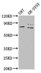 Western Blot  | Positive WB detected in: U87 whole cell lysate, SH-SY5Y whole cell lysate  | All lanes: TIPARP antibody at 4.6µg/ml  | Secondary  | Goat polyclonal to rabbit IgG at 1/50000 dilution  | Predicted band size: 77 kDa  | Observed band size: 77 kDaRabbit anti-Human TIPARP Polyclonal Antibody