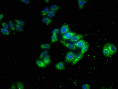 Immunofluorescence staining of HepG2 cells with CACNA2D4 Antibody at 1:133, counter-stained with DAPI. The cells were fixed in 4% formaldehyde, permeabilized using 0.2% Triton X-100 and blocked in 10% normal Goat Serum. The cells were then incubated with the antibody overnight at 4°C. The secondary antibody was Alexa Fluor 488-congugated AffiniPure Goat Anti-Rabbit IgG(H+L).