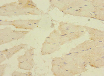 Immunohistochemistry of paraffin-embedded human skeletal muscle tissue using the antibody at dilution of 1:100