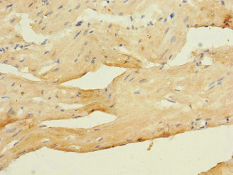 Immunohistochemistry of paraffin-embedded human heart tissue using CACNA2D4 Antibody at dilution of 1:100