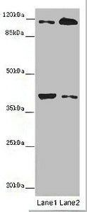 Western blot | All lanes: MILR1 antibody at 14 μg/ml | Lane 1: Mouse brain tissue | Lane 2: HepG2 whole cell lysate | Secondary | Goat polyclonal to rabbit IgG at 1/10000 dilution | Predicted band size: 39, 28, 29 kDa | Observed band size: 39, 120 kDa