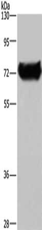 Gel: 8%SDS-PAGE, Lysate: 40 μg, Lane: HepG2 cells, Primary antibody: DDX53 Antibody(DDX53 Antibody) at dilution 1/200, Secondary antibody: Goat anti rabbit IgG at 1/8000 dilution, Exposure time: 1 minuteRabbit anti-Human DDX53 Polyclonal Antibody