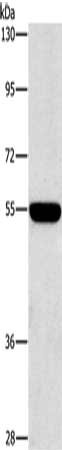 Gel: 8%SDS-PAGE, Lysate: 40 μg, Lane: A549 cells, Primary antibody: SIGLEC7 Antibody(SIGLEC7 Antibody) at dilution 1/650, Secondary antibody: Goat anti rabbit IgG at 1/8000 dilution, Exposure time: 20 secondsRabbit anti-Human SIGLEC7 Polyclonal Antibody