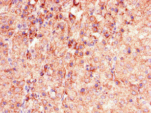Immunohistochemistry of paraffin-embedded human adrenal gland tissue using PHLDB2 Antibody at dilution of 1:100Rabbit anti-Human PHLDB2 Polyclonal Antibody