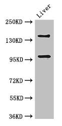 Western Blot | Positive WB detected in: Mouse liver tissue | All lanes: PHLDB2 antibody at 3μg/ml | Secondary | Goat polyclonal to rabbit IgG at 1/50000 dilution | Predicted band size: 143, 137, 140 kDa | Observed band size: 143, 96 kDaRabbit anti-Human PHLDB2 Polyclonal Antibody