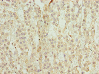 Immunohistochemistry of paraffin-embedded human adrenal gland tissue using TRAPPC6B Antibody at dilution of 1:100Rabbit anti-Human TRAPPC6B Polyclonal Antibody