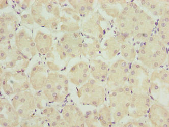 Immunohistochemistry of paraffin-embedded human pancreatic tissue using TRAPPC6B Antibody at dilution of 1:100Rabbit anti-Human TRAPPC6B Polyclonal Antibody