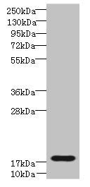 Western blot  | All lanes: TRAPPC6B antibody at 4µg/ml + Mouse kidney tissue  | Secondary  | Goat polyclonal to rabbit IgG at 1/10000 dilution  | Predicted band size: 18, 15 kDa  | Observed band size: 18 kDaRabbit anti-Human TRAPPC6B Polyclonal Antibody