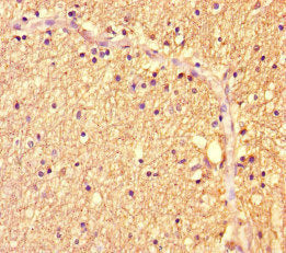 Immunohistochemistry of paraffin-embedded human brain tissue using ZBTB46 Antibody at dilution of 1:100Rabbit anti-Human ZBTB46 Polyclonal Antibody