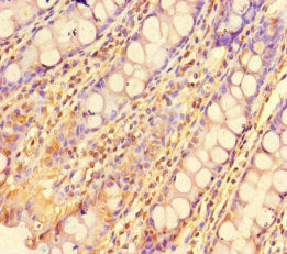 Immunohistochemistry of paraffin-embedded human colon tissue using ZBTB46 Antibody at dilution of 1:100Rabbit anti-Human ZBTB46 Polyclonal Antibody