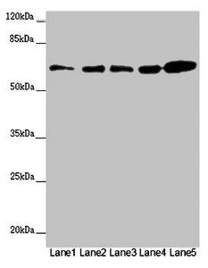 Western blot | All lanes: ZBTB46 antibody at 2μg/ml | Lane 1: Mouse heart tissue | Lane 2: Mouse liver tissue | Lane 3: Mouse kidney tissue | Lane 4: 293T whole cell lysate | Lane 5: SH-SY5Y whole cell lysate | Secondary | Goat polyclonal to rabbit IgG at 1/10000 dilution | Predicted band size: 65 kDa | Observed band size: 65 kDaRabbit anti-Human ZBTB46 Polyclonal Antibody