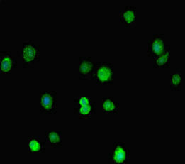 Immunofluorescent analysis of HepG2 cells using MORC1 Antibody at dilution of 1:100 and Alexa Fluor 488-congugated AffiniPure Goat Anti-Rabbit IgG(H+L)Rabbit anti-Human MORC1 Polyclonal Antibody