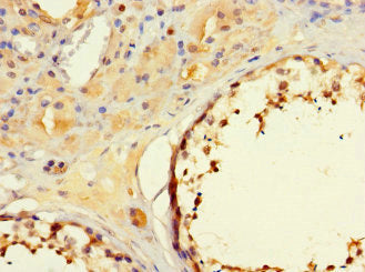 Immunohistochemistry of paraffin-embedded human testis tissue using the antibody at dilution of 1:100Rabbit anti-Human MORC1 Polyclonal Antibody