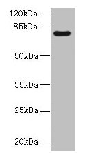 Western blot  | All lanes: TTC30A antibody at 0.1µg/ml + Mouse gonadal tissue  | Secondary  | Goat polyclonal to rabbit IgG at 1/10000 dilution  | Predicted band size: 77 kDa  | Observed band size: 77 kDaRabbit anti-Human TTC30A Polyclonal Antibody