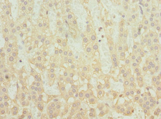 Immunohistochemistry of paraffin-embedded human adrenal gland tissue using SNX32 Antibody at dilution of 1:100