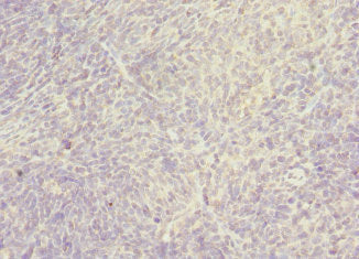 Immunohistochemistry of paraffin-embedded human thymus tissue using SNX32 Antibody at dilution of 1:100