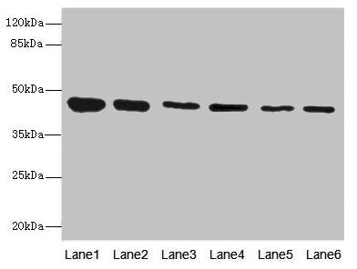 Western blot | All lanes: SNX32 antibody at 6.48μg/ml | Lane 1: Mouse brain tissue | Lane 2: Rat brain tissue | Lane 3: Mouse liver tissue | Lane 4: Mouse stomach tissue | Lane 5: Mouse lung tissue | Lane 6: Mouse kidney tissue | Secondary | Goat polyclonal to rabbit IgG at 1/10000 dilution | Predicted band size: 47, 32 kDa | Observed band size: 47 kDa