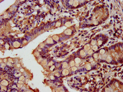 IHC image of GATAD2A Antibody diluted at 1:800 and staining in paraffin-embedded human small intestine tissue performed on a Leica BondTM system. After dewaxing and hydration, antigen retrieval was mediated by high pressure in a citrate buffer (pH 6.0). Section was blocked with 10% normal goat serum 30min at RT. Then primary antibody (1% BSA) was incubated at 4°C overnight. The primary is detected by a biotinylated secondary antibody and visualized using an HRP conjugated SP system.Rabbit anti-Human GATAD2A Polyclonal Antibody