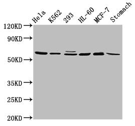 Western Blot | Positive WB detected in: Hela whole cell lysate, K562 whole cell lysate, 293 whole cell lysate, HL60 whole cell lysate, MCF-7 whole cell lysate, Rat stomach tissue | All lanes: GATAD2A antibody at 2.9μg/ml | Secondary | Goat polyclonal to rabbit IgG at 1/50000 dilution | Predicted band size: 69, 66 kDa | Observed band size: 69 kDaRabbit anti-Human GATAD2A Polyclonal Antibody