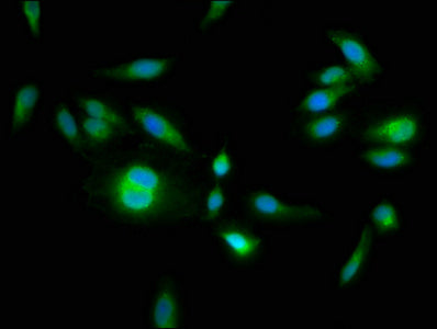 Immunofluorescence staining of Hela cells with HPS6 Antibody at 1:133, counter-stained with DAPI. The cells were fixed in 4% formaldehyde, permeabilized using 0.2% Triton X-100 and blocked in 10% normal Goat Serum. The cells were then incubated with the antibody overnight at 4°C. The secondary antibody was Alexa Fluor 488-congugated AffiniPure Goat Anti-Rabbit IgG(H+L).Rabbit anti-Human HPS6 Polyclonal Antibody