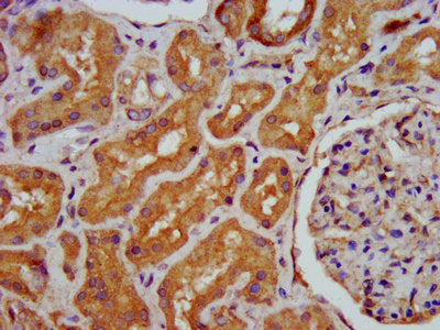 IHC image of the antibody diluted at 1:400 and staining in paraffin-embedded human kidney tissue performed on a Leica BondTM system. After dewaxing and hydration, antigen retrieval was mediated by high pressure in a citrate buffer (pH 6.0). Section was blocked with 10% normal goat serum 30min at RT. Then primary antibody (1% BSA) was incubated at 4°C overnight. The primary is detected by a biotinylated secondary antibody and visualized using an HRP conjugated SP system.Rabbit anti-Human HPS6 Polyclonal Antibody