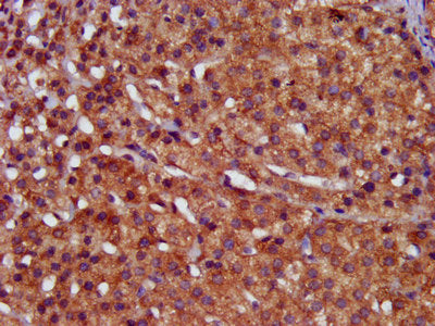 IHC image of HPS6 Antibody diluted at 1:400 and staining in paraffin-embedded human adrenal gland tissue performed on a Leica BondTM system. After dewaxing and hydration, antigen retrieval was mediated by high pressure in a citrate buffer (pH 6.0). Section was blocked with 10% normal goat serum 30min at RT. Then primary antibody (1% BSA) was incubated at 4°C overnight. The primary is detected by a biotinylated secondary antibody and visualized using an HRP conjugated SP system.Rabbit anti-Human HPS6 Polyclonal Antibody