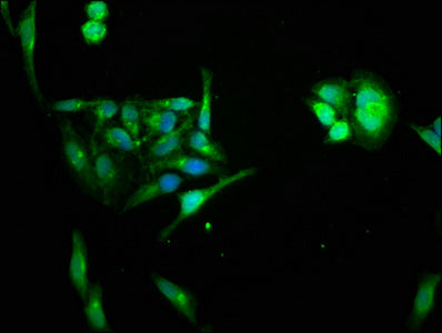 Immunofluorescence staining of Hela cells with HIPK1 Antibody at 1:66, counter-stained with DAPI. The cells were fixed in 4% formaldehyde, permeabilized using 0.2% Triton X-100 and blocked in 10% normal Goat Serum. The cells were then incubated with the antibody overnight at 4°C. The secondary antibody was Alexa Fluor 488-congugated AffiniPure Goat Anti-Rabbit IgG(H+L).Rabbit anti-Human HIPK1 Polyclonal Antibody