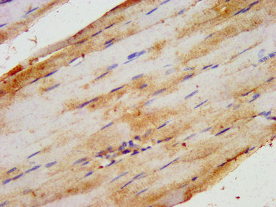 IHC image of the antibody diluted at 1:200 and staining in paraffin-embedded human skeletal muscle tissue performed on a Leica BondTM system. After dewaxing and hydration, antigen retrieval was mediated by high pressure in a citrate buffer (pH 6.0). Section was blocked with 10% normal goat serum 30min at RT. Then primary antibody (1% BSA) was incubated at 4°C overnight. The primary is detected by a biotinylated secondary antibody and visualized using an HRP conjugated SP system.Rabbit anti-Human HIPK1 Polyclonal Antibody