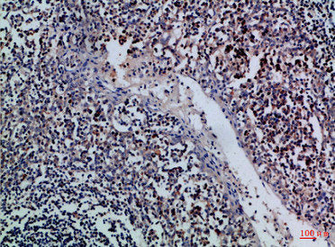 Immunohistochemical analysis of paraffin-embedded Human-tonsil, antibody was diluted at 1:100Rabbit anti-Human GZMM Polyclonal Antibody