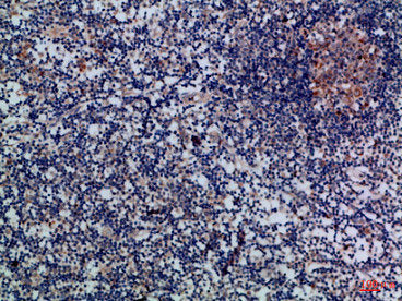 Immunohistochemical analysis of paraffin-embedded Human-lymph, antibody was diluted at 1:100Rabbit anti-Human GZMM Polyclonal Antibody
