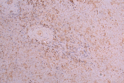IHC image of Clec4g Antibody diluted at 1:66 and staining in paraffin-embedded human spleen tissue performed on a Leica BondTM system. After dewaxing and hydration, antigen retrieval was mediated by high pressure in a citrate buffer (pH 6.0). Section was blocked with 10% normal goat serum 30min at RT. Then primary antibody (1% BSA) was incubated at 4°C overnight. The primary is detected by a Goat anti-rabbit polymer IgG labeled by HRP and visualized using 0.05% DAB.Rabbit anti-Mus musculus (Mouse) Clec4g Polyclonal Antibody