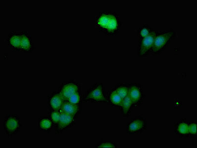 Immunofluorescent analysis of PC-3 cells using ANO1 Antibody at dilution of 1:100 and Alexa Fluor 488-congugated AffiniPure Goat Anti-Rabbit IgG(H+L)Rabbit anti-Human ANO1 Polyclonal Antibody