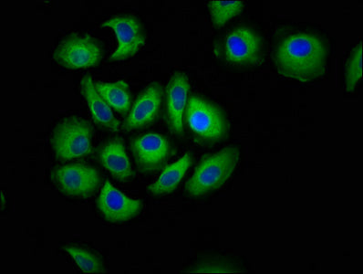 Immunofluorescence staining of A549 cells with CDH7 Antibody at 1:133, counter-stained with DAPI. The cells were fixed in 4% formaldehyde, permeabilized using 0.2% Triton X-100 and blocked in 10% normal Goat Serum. The cells were then incubated with the antibody overnight at 4°C. The secondary antibody was Alexa Fluor 488-congugated AffiniPure Goat Anti-Rabbit IgG(H+L).Rabbit anti-Human CDH7 Polyclonal Antibody