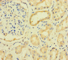 Immunohistochemistry of paraffin-embedded human kidney tissue using the antibody at dilution of 1:100Rabbit anti-Human PRKAA2 Polyclonal Antibody