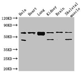 Western Blot | Positive WB detected in: Hela whole cell lysate, Mouse heart tissue, Mouse lung tissue, Mouse kidney tissue, Mouse brain tissue, Mouse skeletal muscle tissue | All lanes: PRKAA2 antibody at 2.7μg/ml | Secondary | Goat polyclonal to rabbit IgG at 1/50000 dilution | Predicted band size: 63 kDa | Observed band size: 63, 48 kDaRabbit anti-Human PRKAA2 Polyclonal Antibody