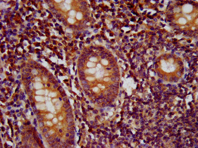 IHC image of Wdr37 Antibody diluted at 1:500 and staining in paraffin-embedded human appendix tissue performed on a Leica BondTM system. After dewaxing and hydration, antigen retrieval was mediated by high pressure in a citrate buffer (pH 6.0). Section was blocked with 10% normal goat serum 30min at RT. Then primary antibody (1% BSA) was incubated at 4°C overnight. The primary is detected by a biotinylated secondary antibody and visualized using an HRP conjugated SP system.Rabbit anti-Mus musculus (Mouse) Wdr37 Polyclonal Antibody