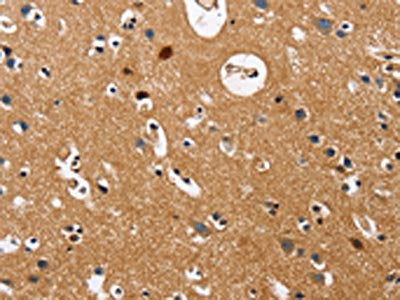 The image on the left is immunohistochemistry of paraffin-embedded Human brain  tissue using GNA13 Antibody(GNA13 Antibody) at dilution 1/20, on the right is treated with fusion protein. (Original magnification: ×200)Rabbit anti-Human GNA13 Polyclonal Antibody