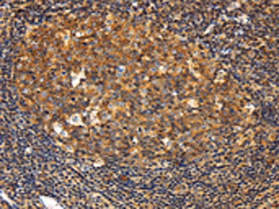 The image on the left is immunohistochemistry of paraffin-embedded Human tonsil tissue using the antibody Antibody) at dilution 1/20, on the right is treated with fusion protein. (Original magnification: ×200)Rabbit anti-Human GNA13 Polyclonal Antibody
