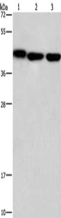 Gel: 15%SDS-PAGE, Lysate: 40 μg, Lane 1-3: Mouse kidney tissue, human testis tissue, Human brain malignant glioma tissue, Primary antibody: GNA13 Antibody(GNA13 Antibody) at dilution 1/450, Secondary antibody: Goat anti rabbit IgG at 1/8000 dilution, Exposure time: 1 minuteRabbit anti-Human GNA13 Polyclonal Antibody